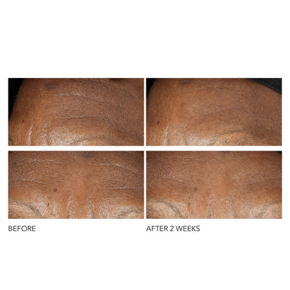 Dr Dennis Gross Advanced Retinol + Ferulic Intense Wrinkle Cream | Intensely Hydrating to Visibly Transform Skin and Repair the Moisture Barrier | 2 oz - Maple Wellness Supplements