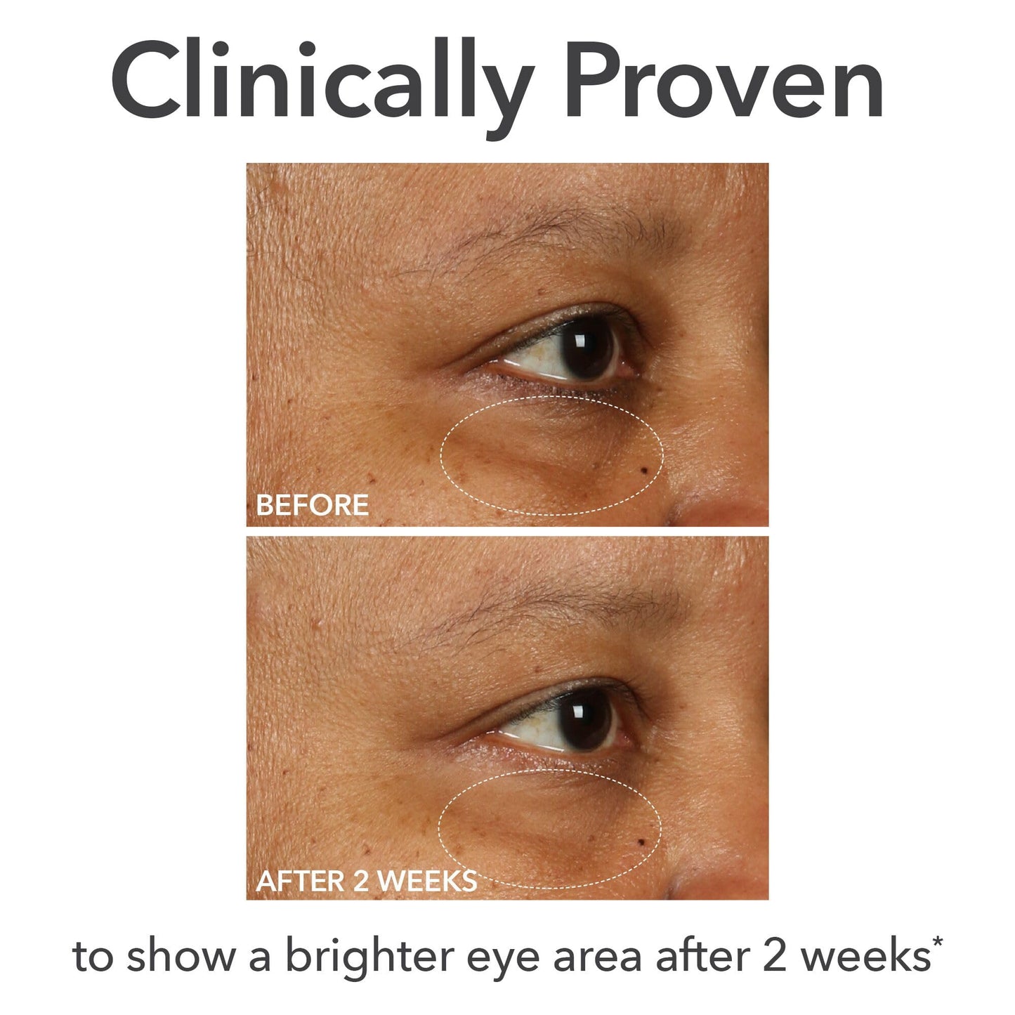 Dr Dennis Gross DermInfusions Fill + Repair Eye Cream: Hydrating & Brightening Treatment for Dark Circles, Fine Lines & Wrinkles, Firms & Smooths 360° Eye Area, 0.5 Oz - Maple Wellness Supplements