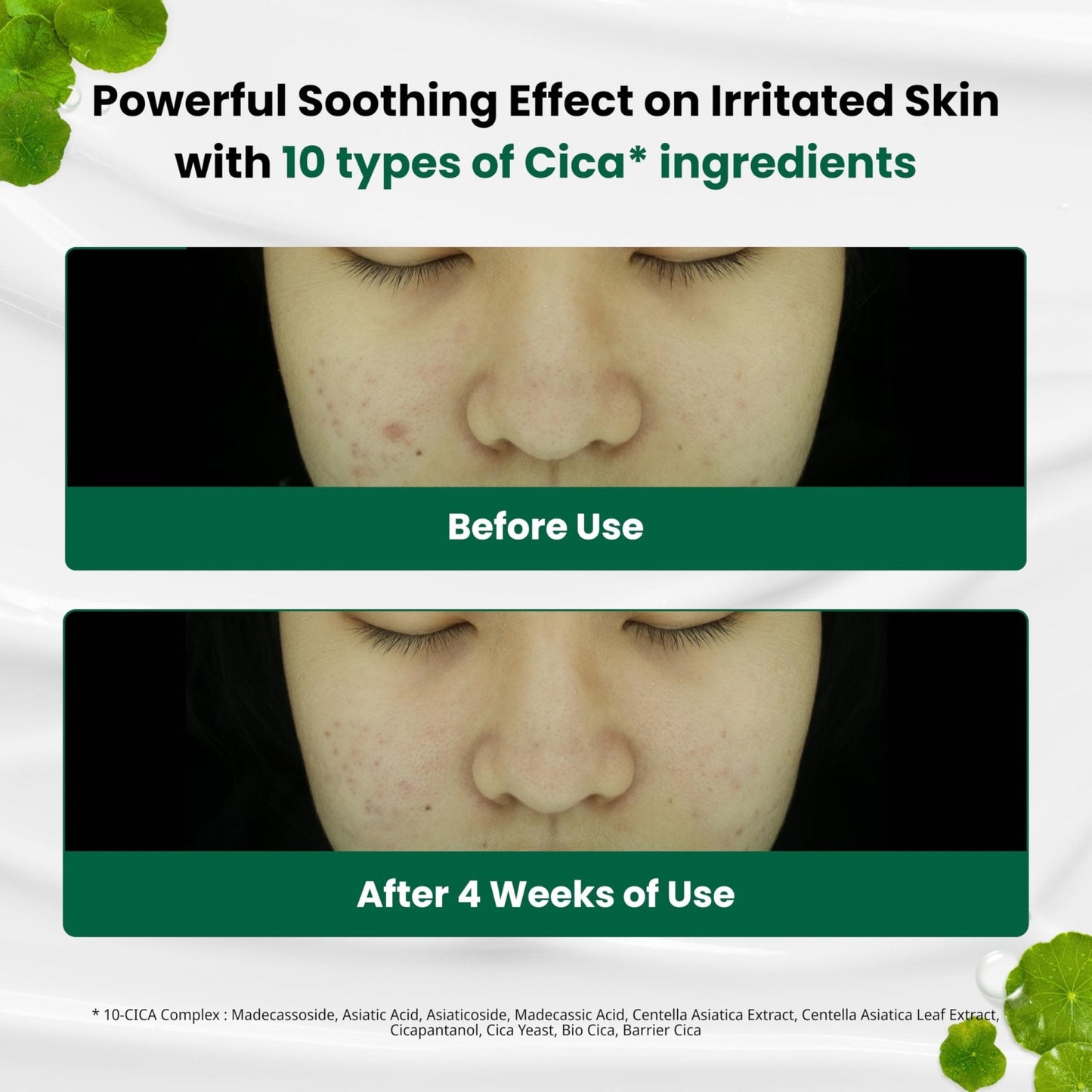 Dr. G R.E.D. Blemish Clear Soothing Cream - Calming Korean Moisturizer for Redness - Soothes Acne & Irritation - Maple Wellness Supplements