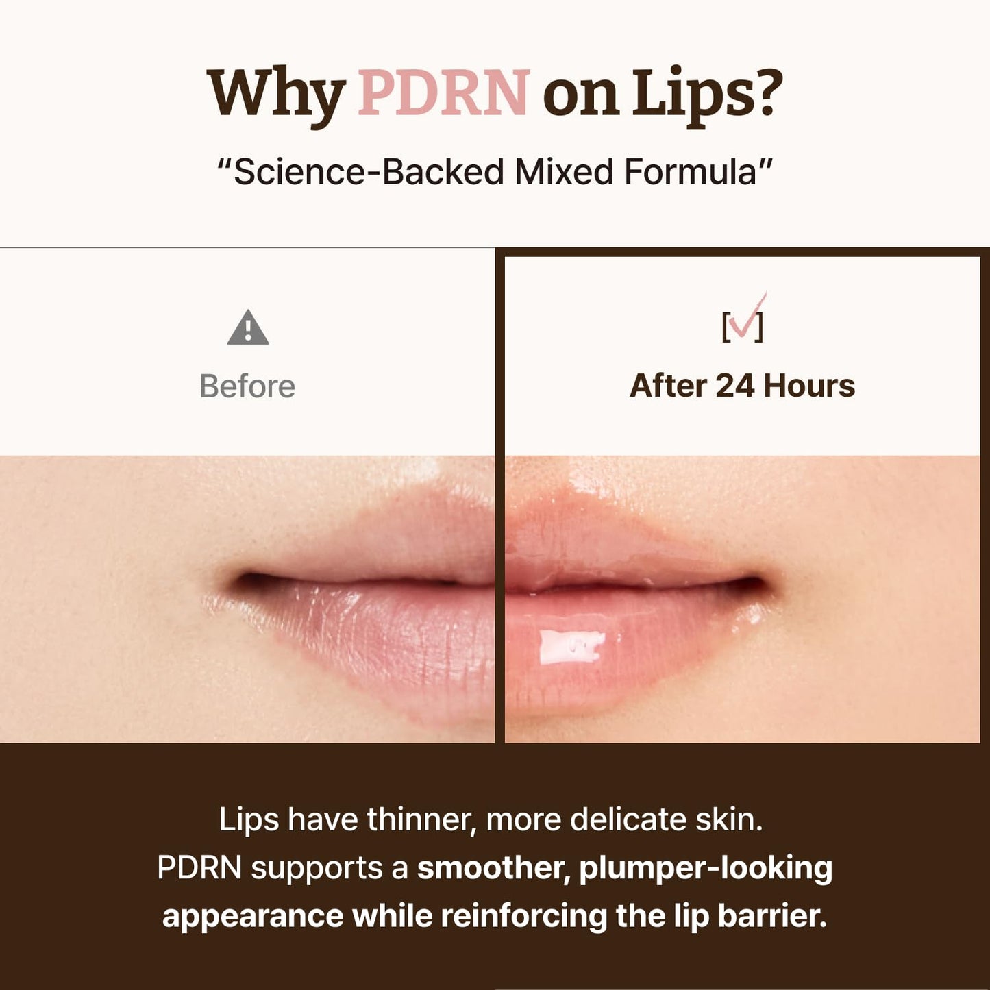 Dr. Reju-All Advanced PDRN Rejuvenating Lip Serum – Hydrating Lip Balm with Lipozip PDRN for Glowy, Dewy Lips - Maple Wellness Supplements