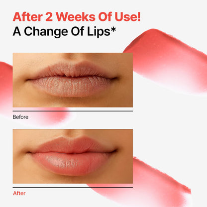 Dr.Different Retinal Lip Balm Tinted, Anti-Wrinkle Lip Treatment with Deep Hydration & Long-Lasting Moisture - Maple Wellness Supplements