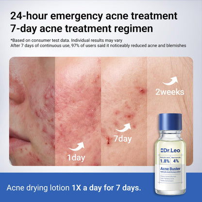 Dr.Leo 1.8% Salicylic Acid Spot Serum, Acne Treatment for Acne-Prone Sensitive Skin | Niacinamide, Fast Pimple Relief, Fades Acne Marks - Maple Wellness Supplements
