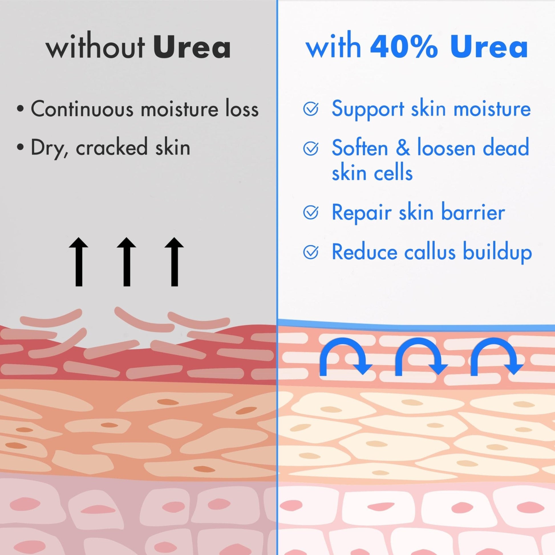 Ebanel Urea Cream 40% plus Salicylic Acid 2%, Foot Cream for Dry Cracked Heels Feet Knees Elbows Hands, Foot Dead Skin Cuticle Callus Remover Toenail Softener, Keratolytic Skin Barrier Repair, 3-Pack - Maple Wellness Supplements