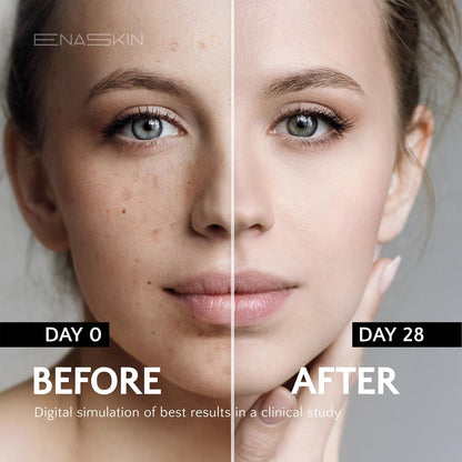 EnaSkin Dark Spot Remover for Face and Body: Advanced Formula Spot Corrector Cream to Fade Age Spots, Sun Spots, Freckles - Maple Wellness Supplements