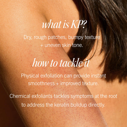 First Aid Beauty - KP Bump Eraser Body Scrub with 10% AHA, Keratosis Pilaris Exfoliator with Glycolic and Lactic acids, Helps Reduce Chicken Skin Bumps - Maple Wellness Supplements