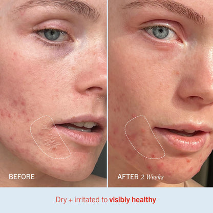 First Aid Beauty - Ultra Repair Cream, Intense Hydration Whipped Colloidal Oatmeal, Clinically Proven to Strengthen Skin Barrier in 7 Days - Maple Wellness Supplements