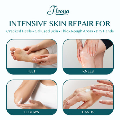 FIVONA 42% Urea Foot Cream for Thick, Rough Dry Skin - Maximum Strength Callus Softening with 2% Salicylic Acid, Tea Tree & Aloe Vera, 100g (3.5 oz) - Deep Moisturizing Foot Care - Maple Wellness Supplements