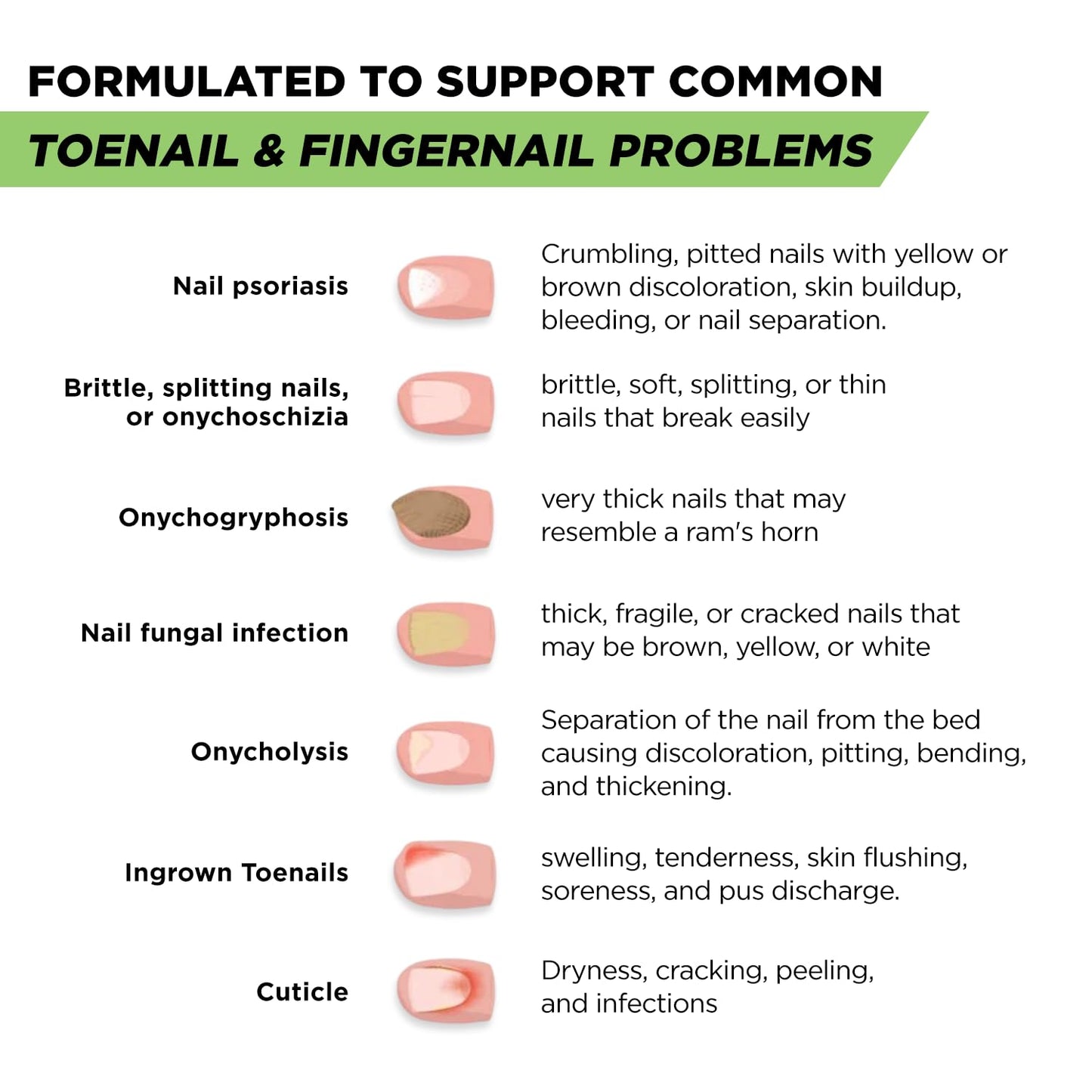Footcure Antifungal Nail Treatment Pen – Extra Strength Toenail Fungus Treatment - Maple Wellness Supplements