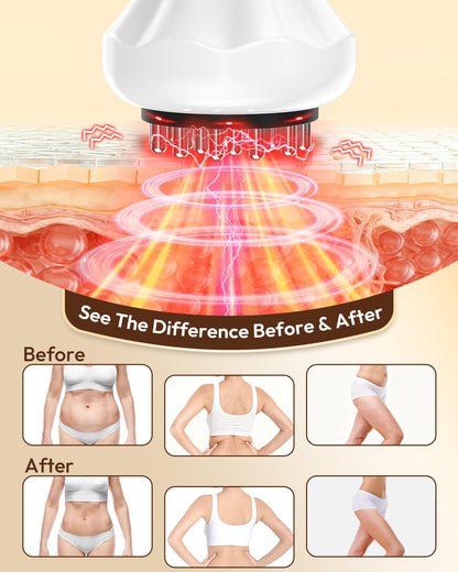 Glamesty Lymphatic Drainage Massager & Anti Cellulite Massage Tool, Body Sculpting Machine with Light, Soothing Pulse, Heat & Vibration, Heated Lymph Brush for Legs, Hip, Arms, Belly (White) - Maple Wellness Supplements
