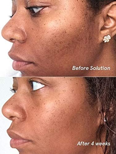 Glossier Solution exfoliating skin perfector 4.4 fl oz / 130 ml - Maple Wellness Supplements