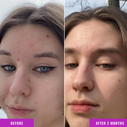 Good Molecules Niacinamide Serum - 10% Niacinamide to Target Blemishes, Nourishment - Maple Wellness Supplements