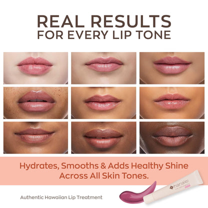 Hanalei Lip Treatment for Dry, Chapped Lips – Intensive Overnight Moisturizer with Kukui Oil - Maple Wellness Supplements