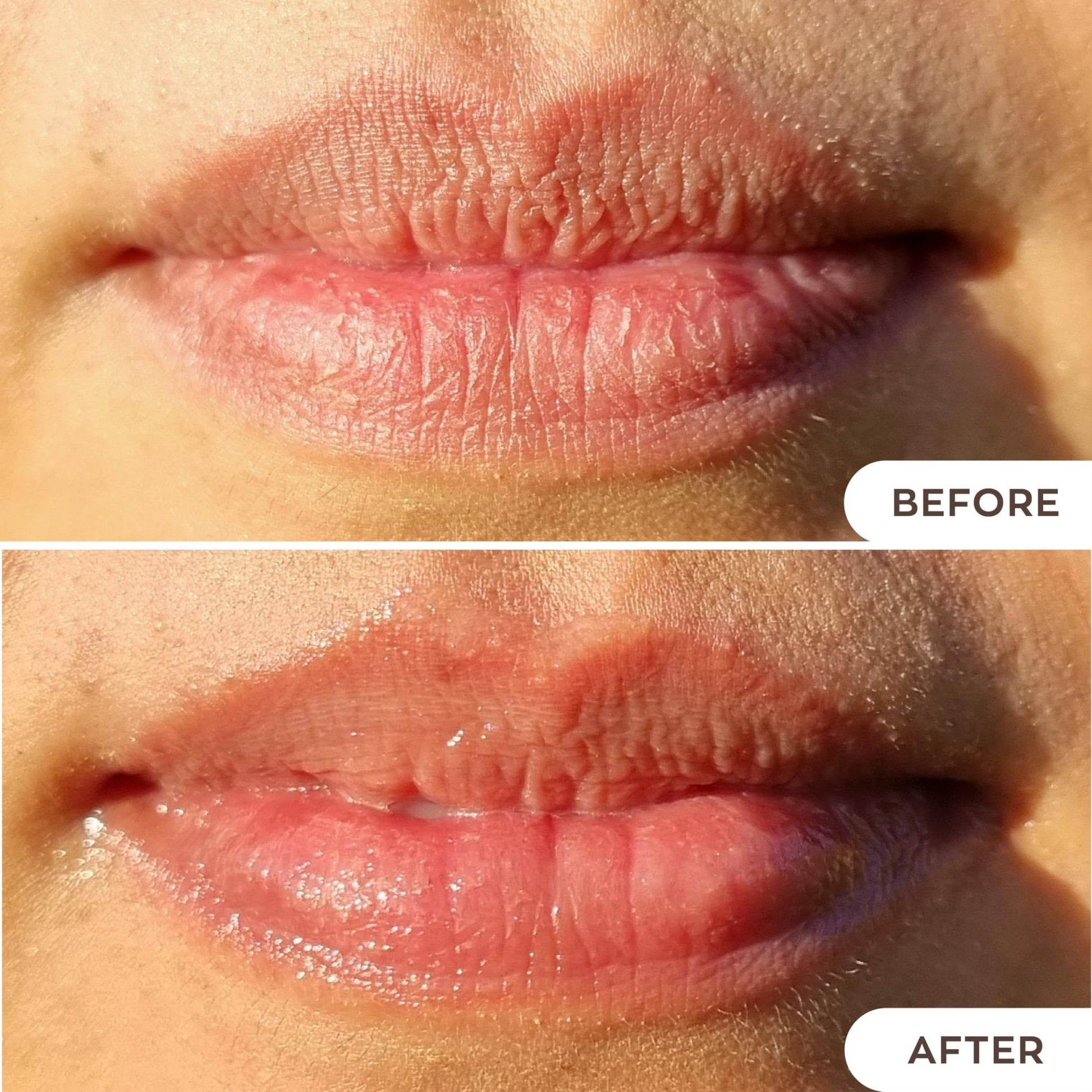 Hanalei Lip Treatment for Dry, Chapped Lips – Intensive Overnight Moisturizer with Kukui Oil - Maple Wellness Supplements