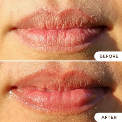 Hanalei Lip Treatment for Dry, Chapped Lips – Intensive Overnight Moisturizer with Kukui Oil - Maple Wellness Supplements
