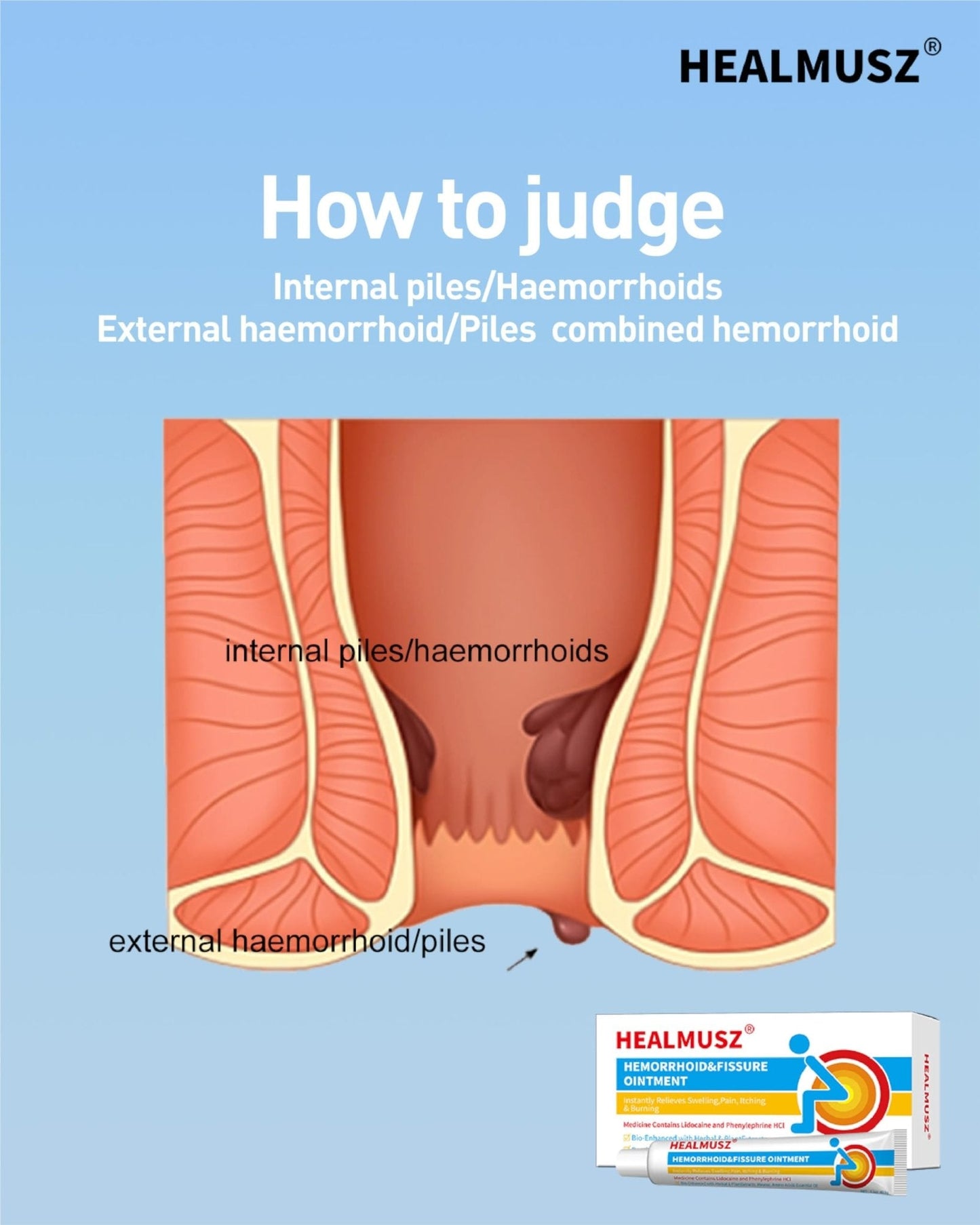 HEALMUSZ Hemorrhoid Fissure Ointment– Hemorrhoid Treatment and Hemorrhoid Cream with Lidocaine and Phenylephrine HCI for Fast Acting Relief of Pain, Swelling, Discomfort, and Itching(1.5 oz) - Maple Wellness Supplements