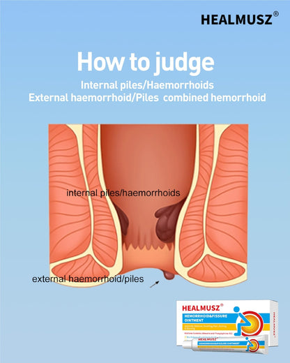 HEALMUSZ Hemorrhoid Fissure Ointment– Hemorrhoid Treatment and Hemorrhoid Cream with Lidocaine and Phenylephrine HCI for Fast Acting Relief of Pain, Swelling, Discomfort, and Itching(1.5 oz) - Maple Wellness Supplements