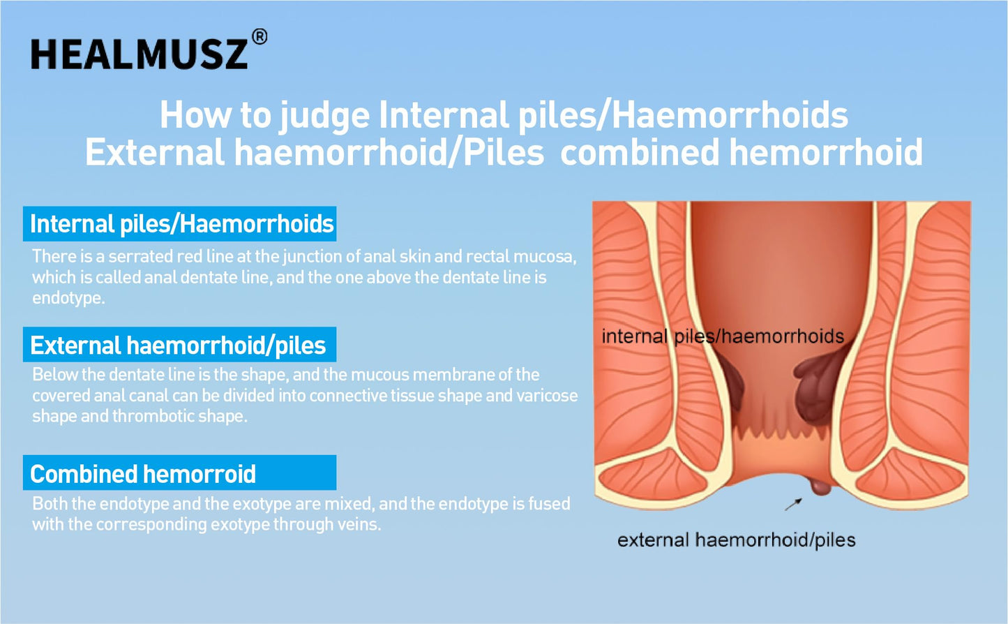 HEALMUSZ Hemorrhoid Fissure Ointment– Hemorrhoid Treatment and Hemorrhoid Cream with Lidocaine and Phenylephrine HCI for Fast Acting Relief of Pain, Swelling, Discomfort, and Itching(1.5 oz) - Maple Wellness Supplements