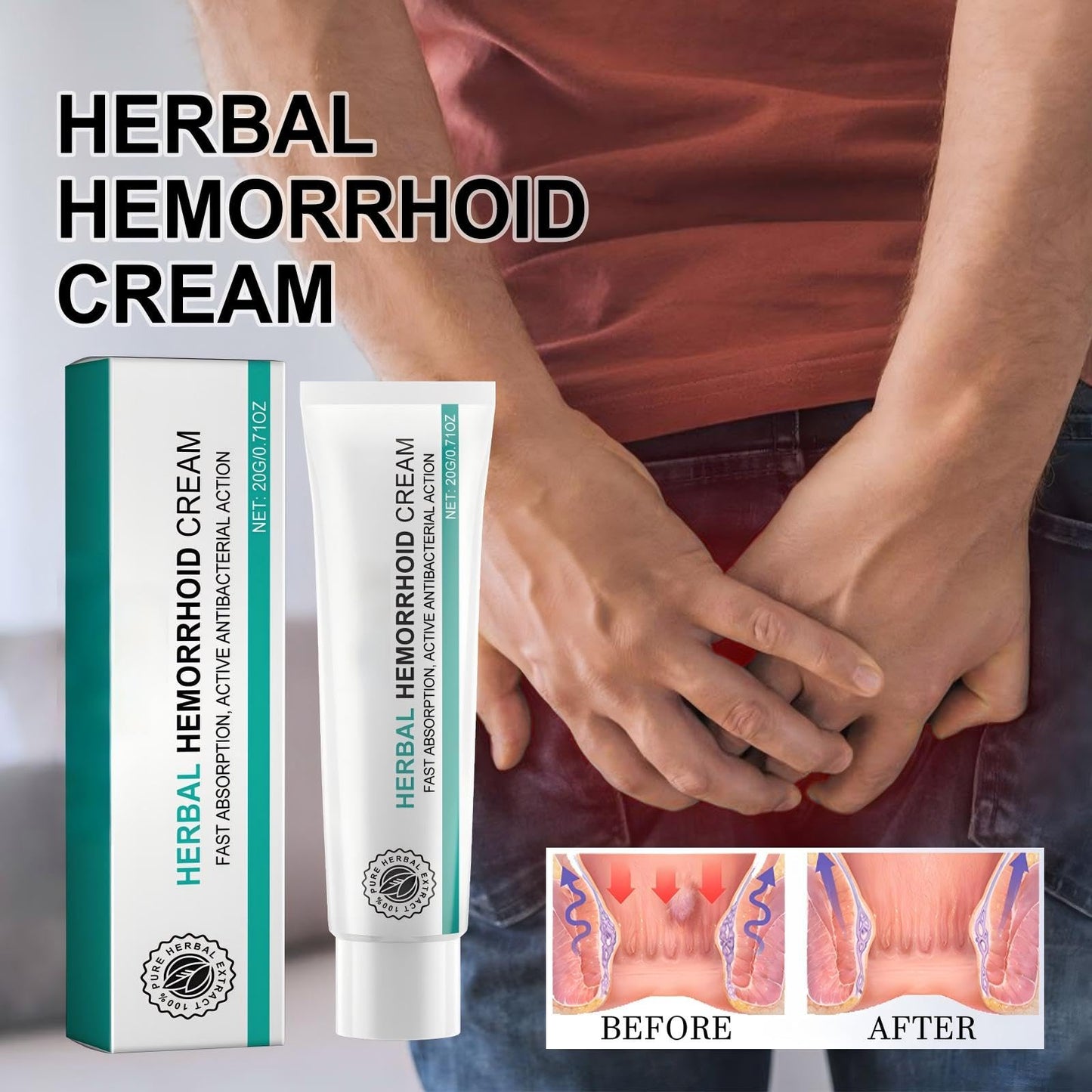 Hemorrhoid Cream, Herbal Hemorrhoid Ointment, Natural Itching & Burning Relief Hemorrhoidal Cream, External Discomfort Support for Men Women 20g - Maple Wellness Supplements