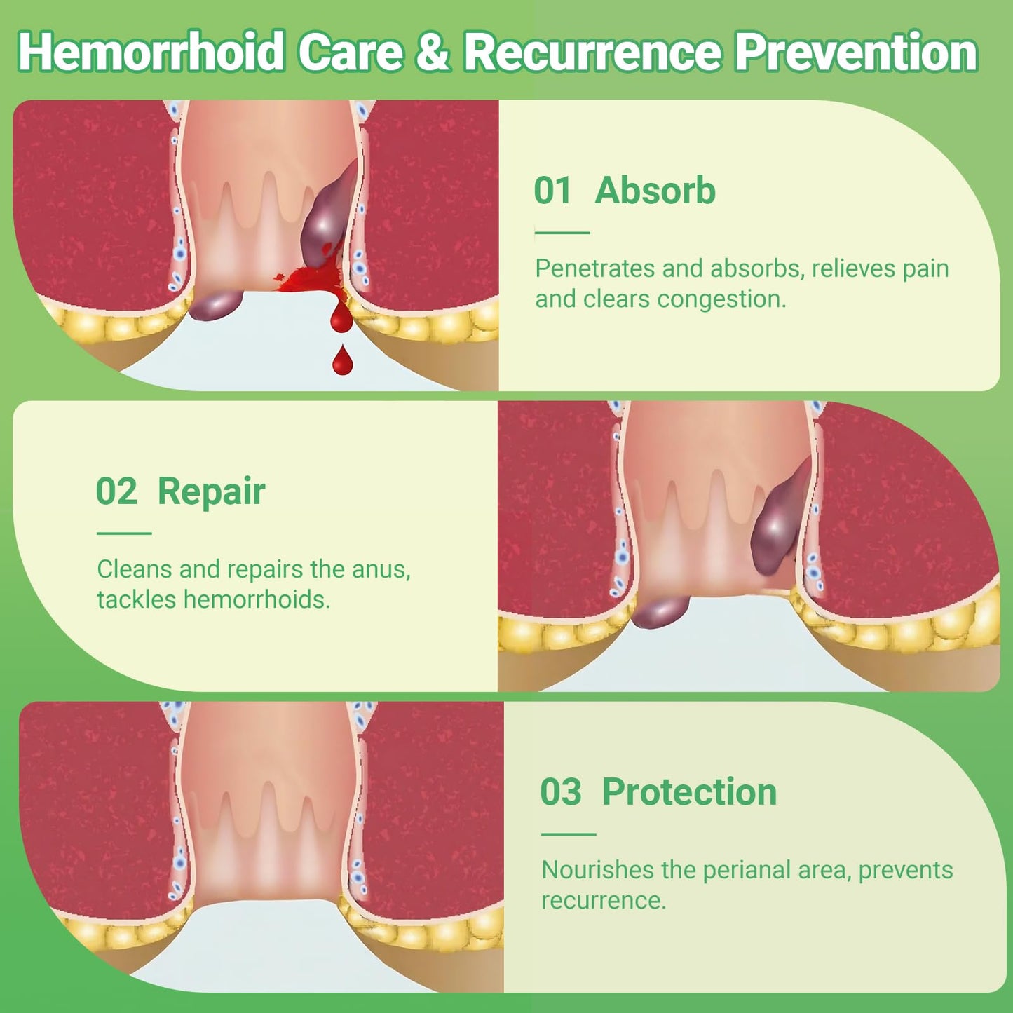 Hemorrhoid Treatment Ointment - Tubesmaximum Strength - Fast Relief from Pain, Itching, Burning, Swelling & Fissures | Natural Aloe & Vitamin E | Travel-Friendly10g x 5 Pieces Tubes - (1.76 Oz) - Maple Wellness Supplements