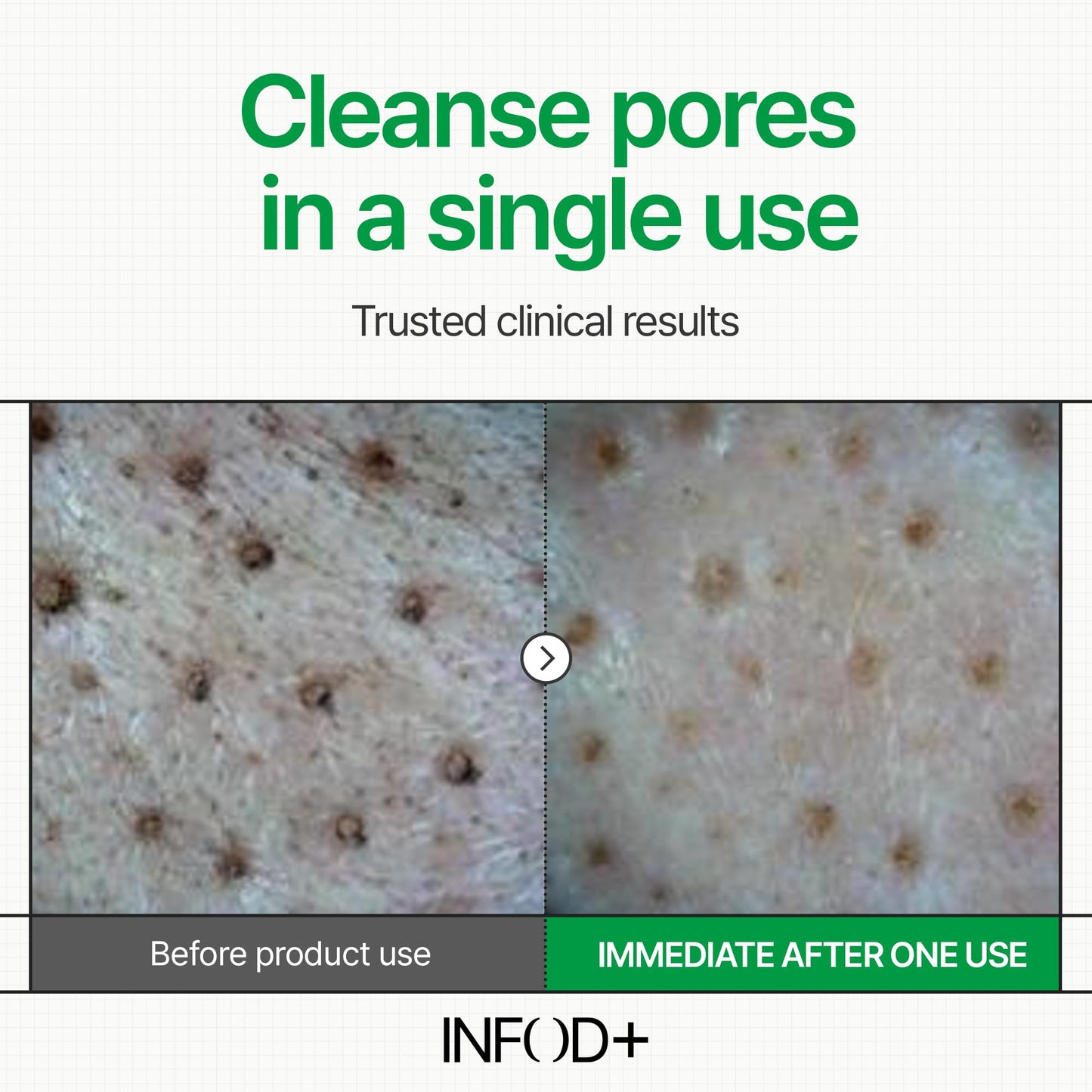 INFODPLUS Gel Cleanser, Gentle Low pH Deep Cleansing, Oil Control, Pore Blackhead Removal Face Wash, Ceramide Panthenol, Hydrating Barrier Balance Korean Skincare for Sensitive Skin, 3.38 fl.oz 100ml - Maple Wellness Supplements