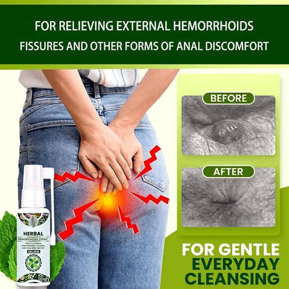 Juztec Hemorrhoid Treatment - Fast Relief with Hemocare Herbal Hemorrhoids Spray & Analese Numb Cream (1 PCS) - Maple Wellness Supplements