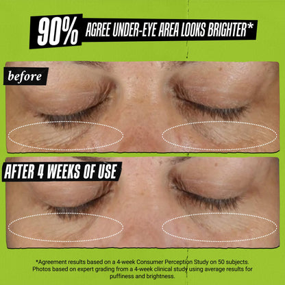 Kiehl's Avocado Eye Treatment, Nourishing and Hydrating Eye Cream, Avocado Oil and Caffeine to Energize and Invigorate Skin, Tired Eyes - Maple Wellness Supplements