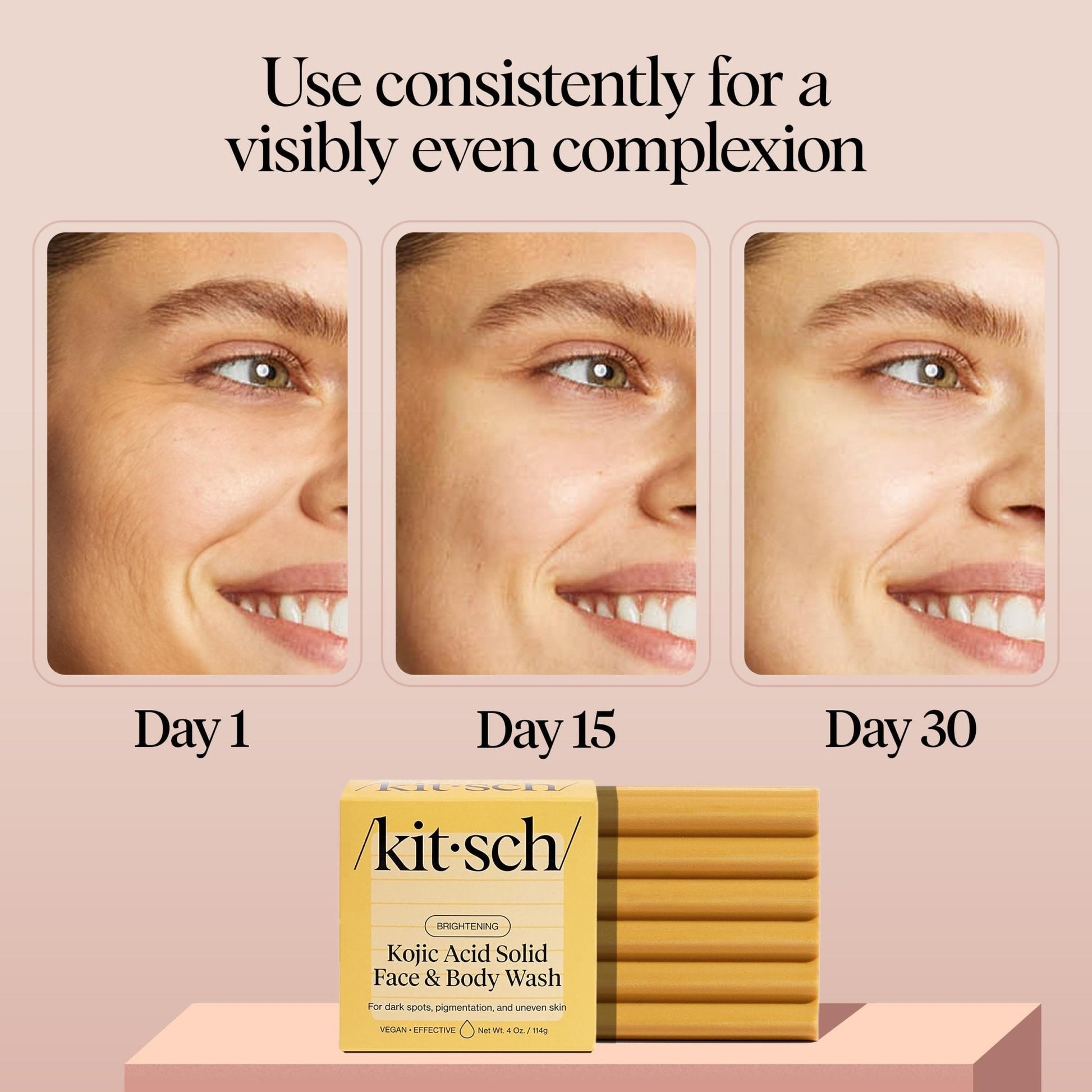 Kitsch Kojic Acid Soap – Turmeric Soap Bar with Hyaluronic Acid & Shea Butter – Brightening & Hydrating Body Wash & Face Wash for Dark Spots - Maple Wellness Supplements