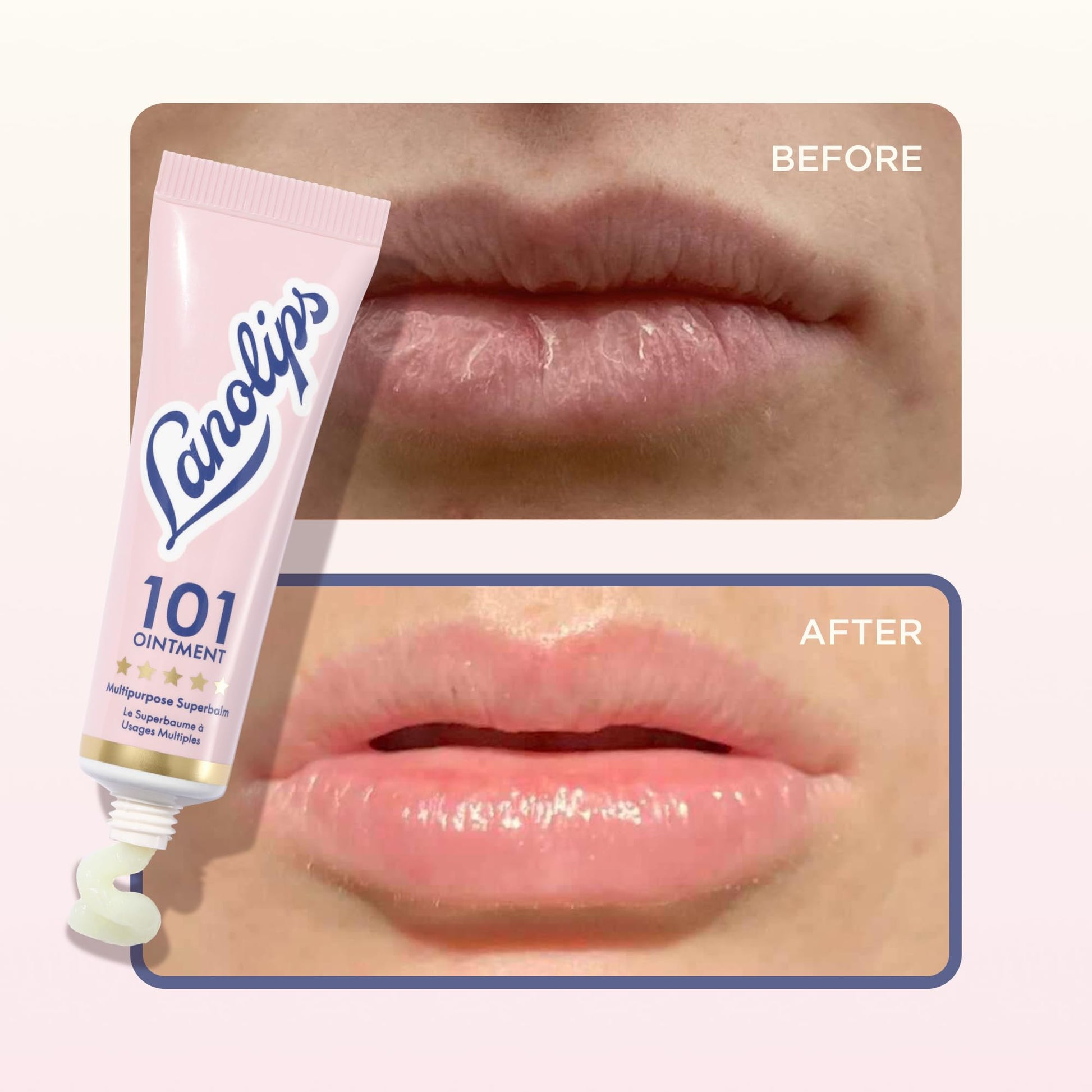 Lanolin 101 Multipurpose Ointment - Lanolin Lip Balm & Healing Ointment for Skin Barrier Repair - Moisturizer for Dry Lips, Cuticles & Elbows - No Petroleum Formula - Original Superbalm (0.52 oz) - Maple Wellness Supplements