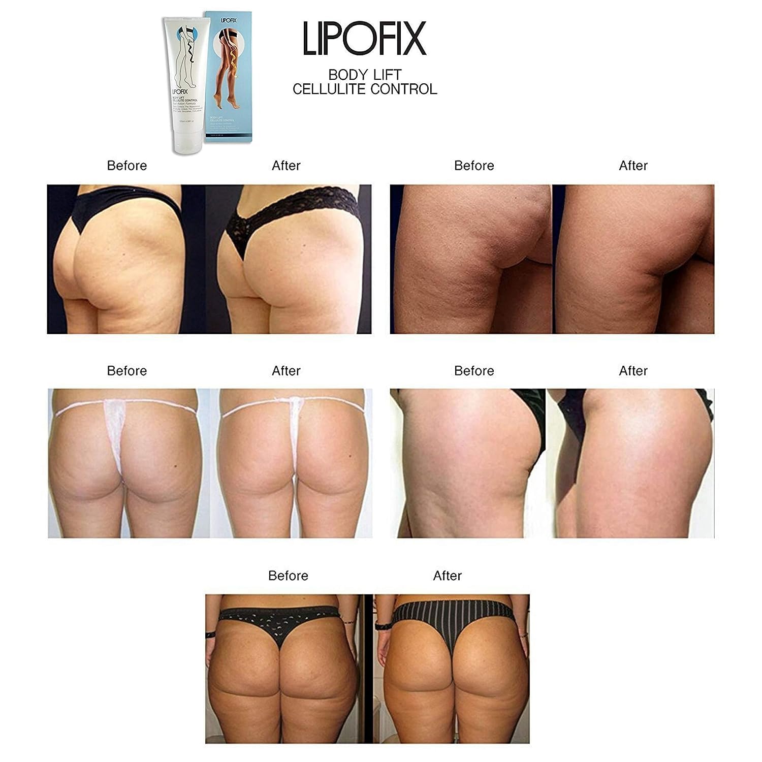 LIPOFIX Anti Cellulite Cream Luxurious Formula Body Contour Cream Effectively Tone - Maple Wellness Supplements
