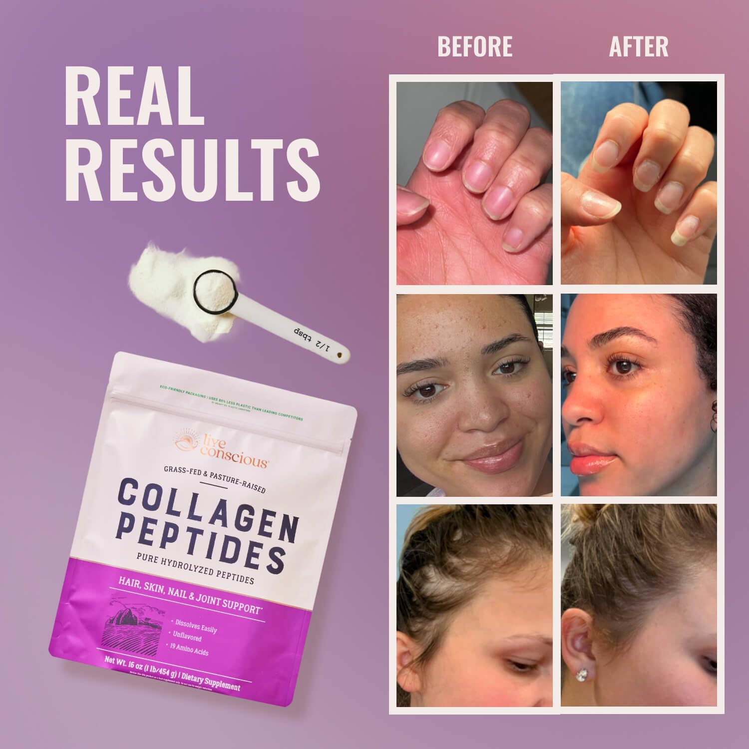Live Conscious Collagen Peptides Powder - Naturally-Sourced Hydrolyzed Collagen Powder - Hair, Skin, Nail, and Joint Support - Type I & III Grass-Fed Collagen - Maple Wellness Supplements