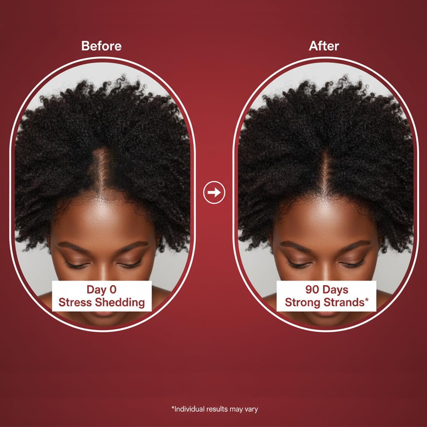Lumin Hair Growth Gummies for Black Women, 60 Vegan Gummies, Daily Hair Nourishment with Biotin, Collagen & Botanical Extracts, Supports Healthy Hair Growth & Strength - Maple Wellness Supplements