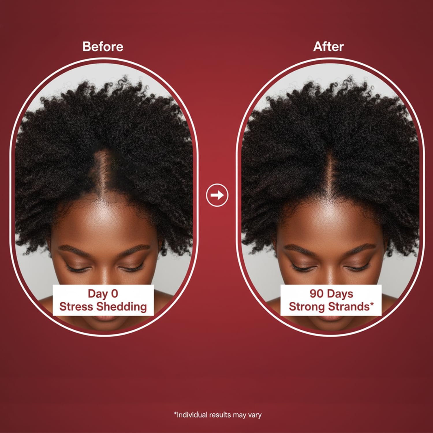 Lumin Hair Growth Gummies for Black Women, 60 Vegan Gummies, Daily Hair Nourishment with Biotin, Collagen & Botanical Extracts, Supports Healthy Hair Growth & Strength - Maple Wellness Supplements