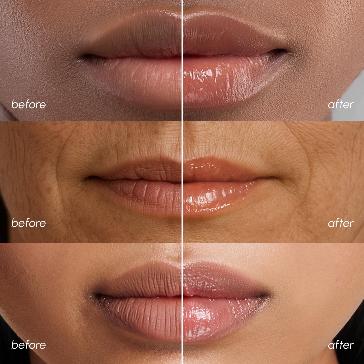 MAREE Lip Mask Overnight - Lip Moisturizer For Very Dry Lips - Hydrating Lip Butter Balm with Hyaluronic Acid & Collagen - Maple Wellness Supplements