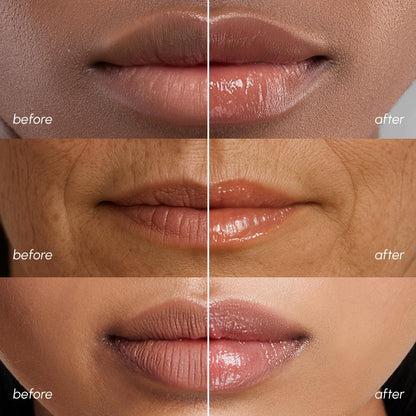 MAREE Lip Mask Overnight - Lip Moisturizer For Very Dry Lips - Hydrating Lip Butter Balm with Hyaluronic Acid & Collagen - Maple Wellness Supplements