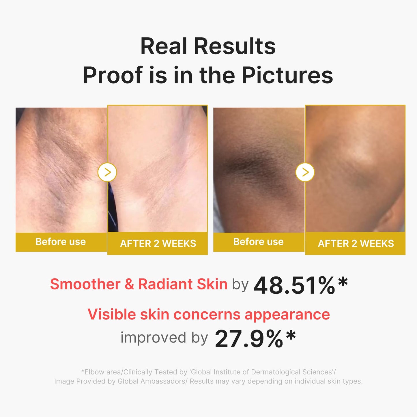 medicube Body Peel Shot with Kojic Acid and Turmeric | Gentle Body Brightening & Exfoliating Serum with BHA, LHA & PHA for Dead Skin Cells - Maple Wellness Supplements