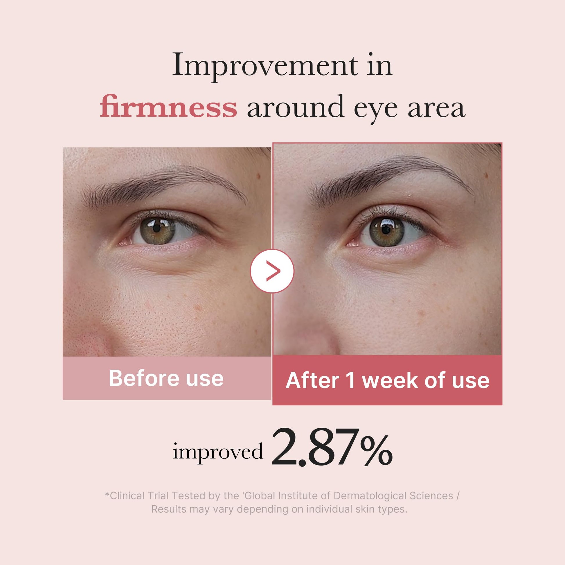medicube Eye Serum with Salmon DNA PDRN & Pink Peptides | 99% Purity Retinol for Fine Lines - Maple Wellness Supplements