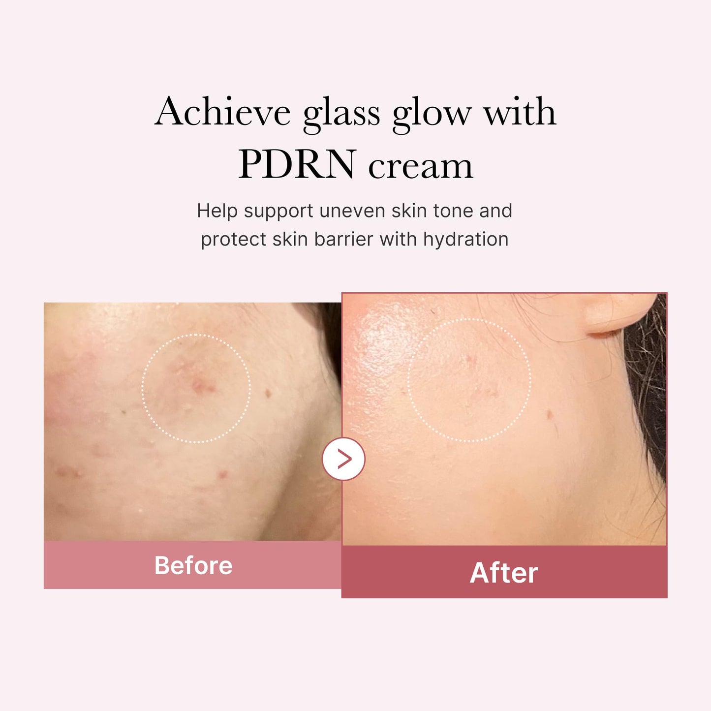 medicube PDRN Pink Hyaluronic Moisturizing Cream | Blemish Recovery, Relief & Hydrating Care | Restores Skin Elasticity & Glow - Maple Wellness Supplements