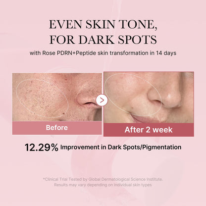 medicube PDRN Toner Rose PDRN Peptide Toner | Lightweight & Watery Type for Skin Boosting, Soothing and Calming, Uneven Skin Tone | with Rose, Peptide, Niacinamide | Korean Skincare, 8.45 fl.oz - Maple Wellness Supplements