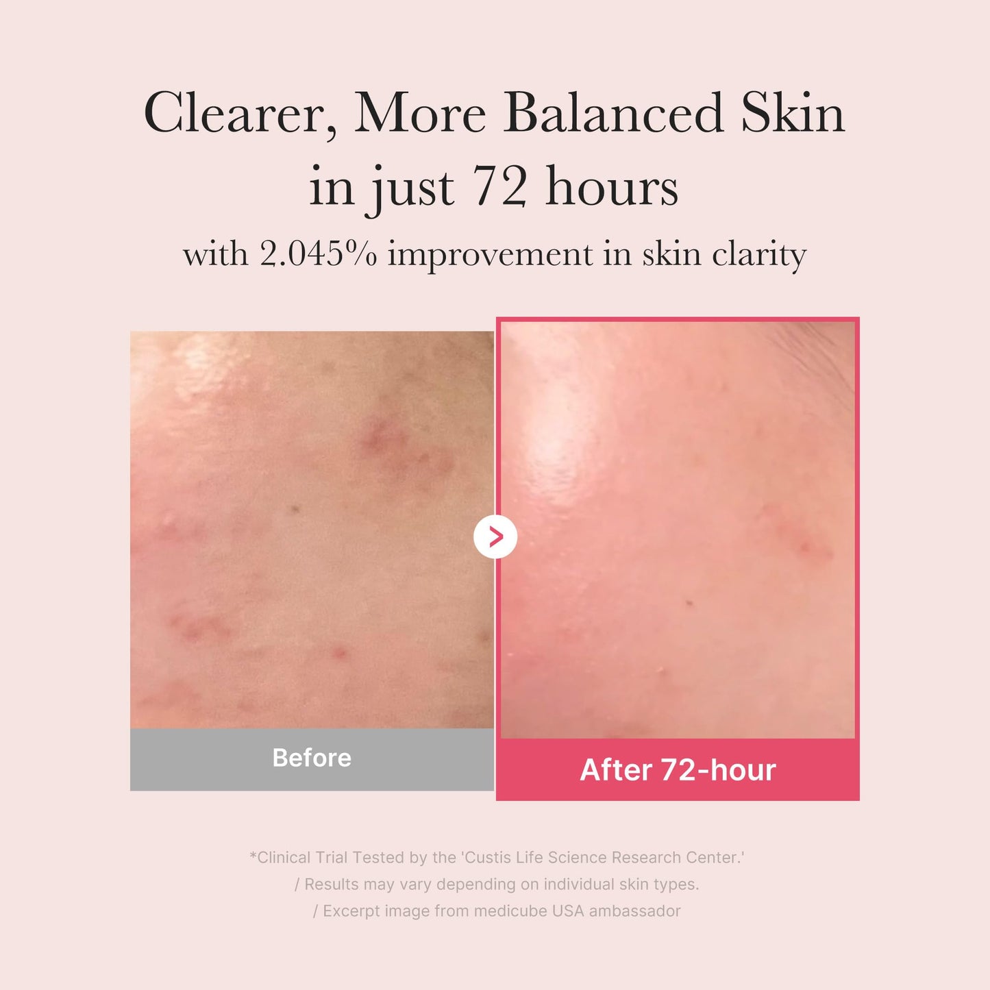medicube TXA+Niacinamide 15% Glow Facial Serum for After Spot Care | All-in-One Daily - Maple Wellness Supplements