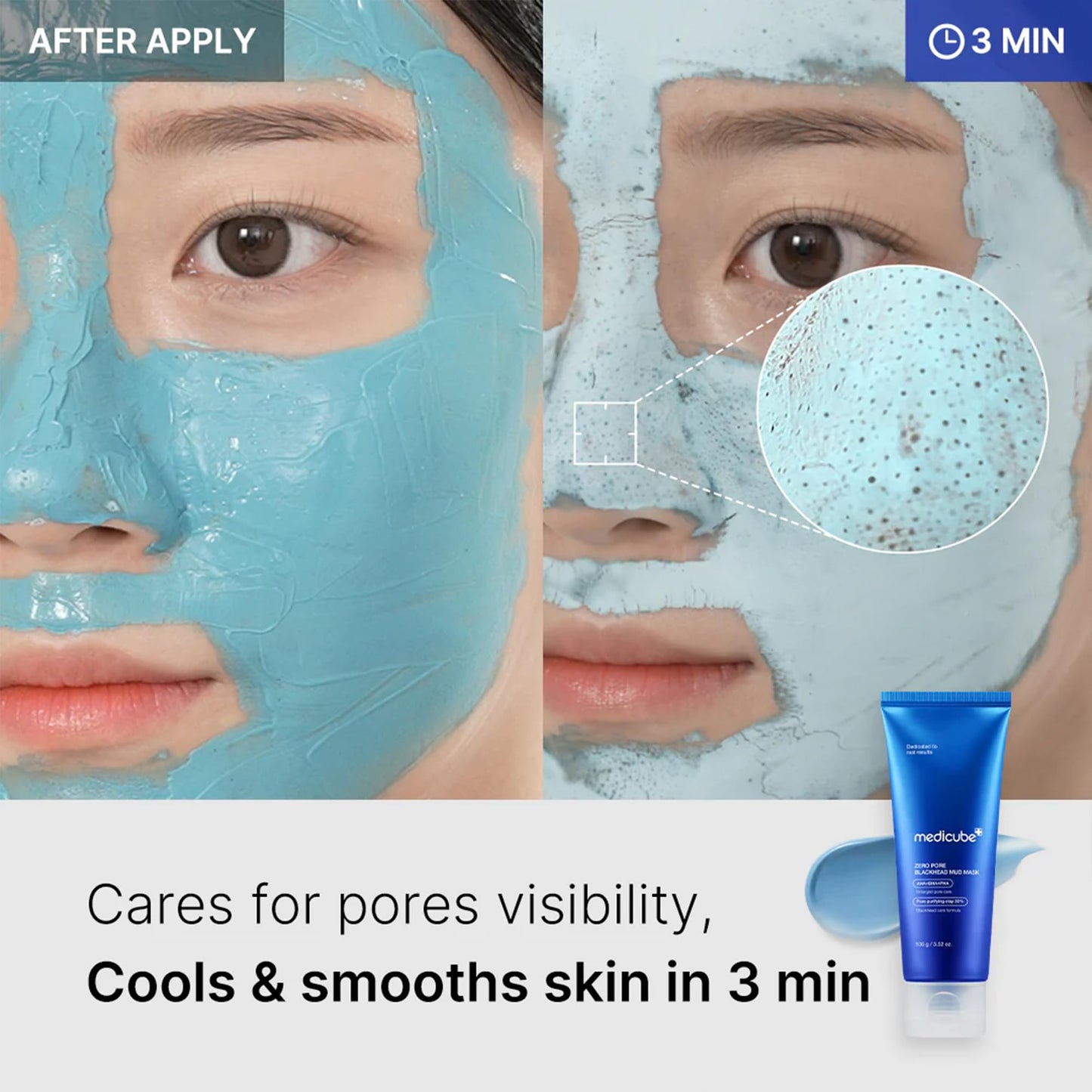 Medicube Zero Pore Blackhead Mud Facial Mask - Skin Cooling & Pore Tightening - 3 Minute Quick Dry Formula with AHA, BHA, PHA - Maple Wellness Supplements