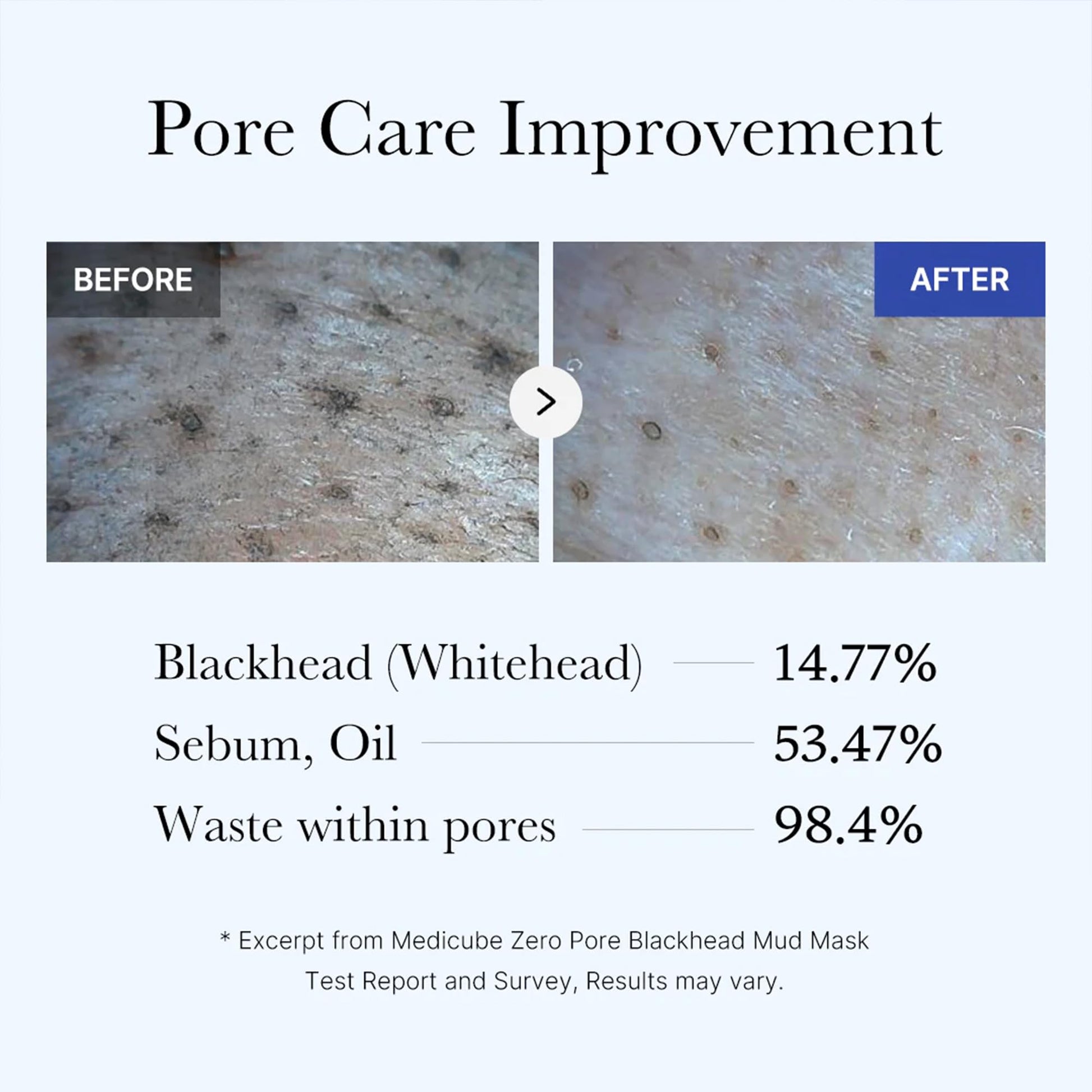Medicube Zero Pore Blackhead Mud Facial Mask - Skin Cooling & Pore Tightening - 3 Minute Quick Dry Formula with AHA, BHA, PHA - Maple Wellness Supplements