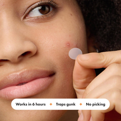 Mighty Patch™ Variety Pack from Hero Cosmetics - Hydrocolloid Acne Pimple Patches for Covering Zits and Blemishes - Maple Wellness Supplements