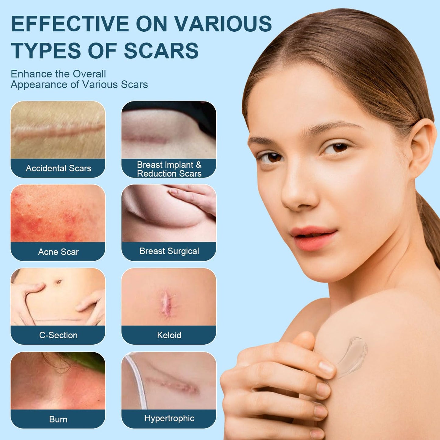 Mitgary Advanced Scar Gel, Silicone Scar Gel, Treats Old and New Scars, Reduces the Appearance of Scars from, Body, Face, Stretch Marks - Maple Wellness Supplements