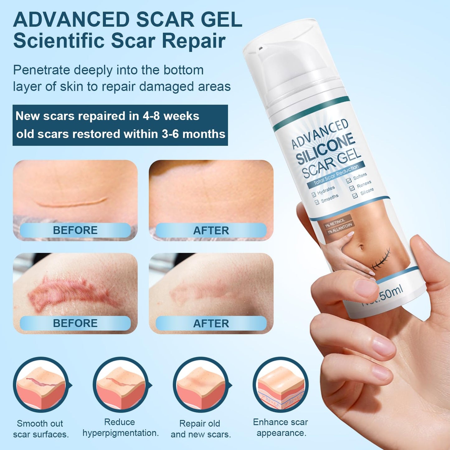 Mitgary Advanced Scar Gel, Silicone Scar Gel, Treats Old and New Scars, Reduces the Appearance of Scars from, Body, Face, Stretch Marks - Maple Wellness Supplements