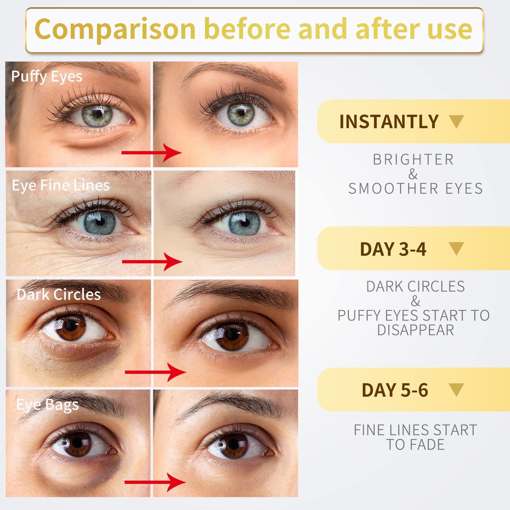 NAZANO 24K Gold Under Eye Patches - 60 Pack for Puffy Eyes, Dark Circles, Bags & Wrinkles - Maple Wellness Supplements