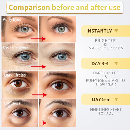 NAZANO 24K Gold Under Eye Patches - 60 Pack for Puffy Eyes, Dark Circles, Bags & Wrinkles - Maple Wellness Supplements