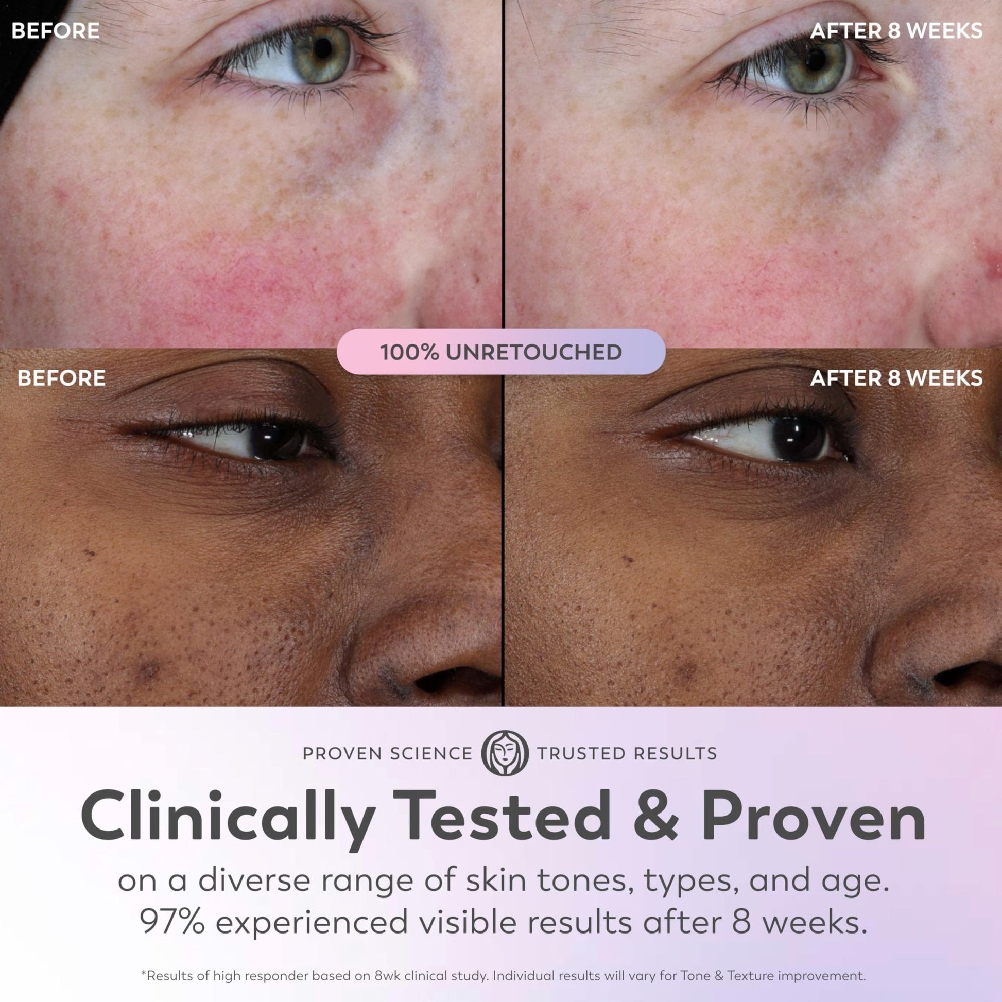 Olay Super Serum - Glow Serum for Face - Activated Niacinamide, Vitamin C & E, Collagen Peptide, AHA - 5-in-1 Benefits - Brightens, Hydrates, Smooths, Firms, Evens Tone, Proactive Anti-Aging, 1.7 Oz - Maple Wellness Supplements