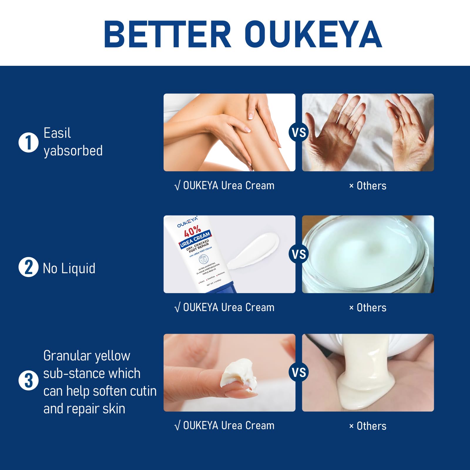 OUKEYA Urea Cream 40 Percent Tube 3 Oz, Foot & Hand Cream for Dry Cracked, 40 per Urea Lotion for Feet Maximum Strength - Maple Wellness Supplements