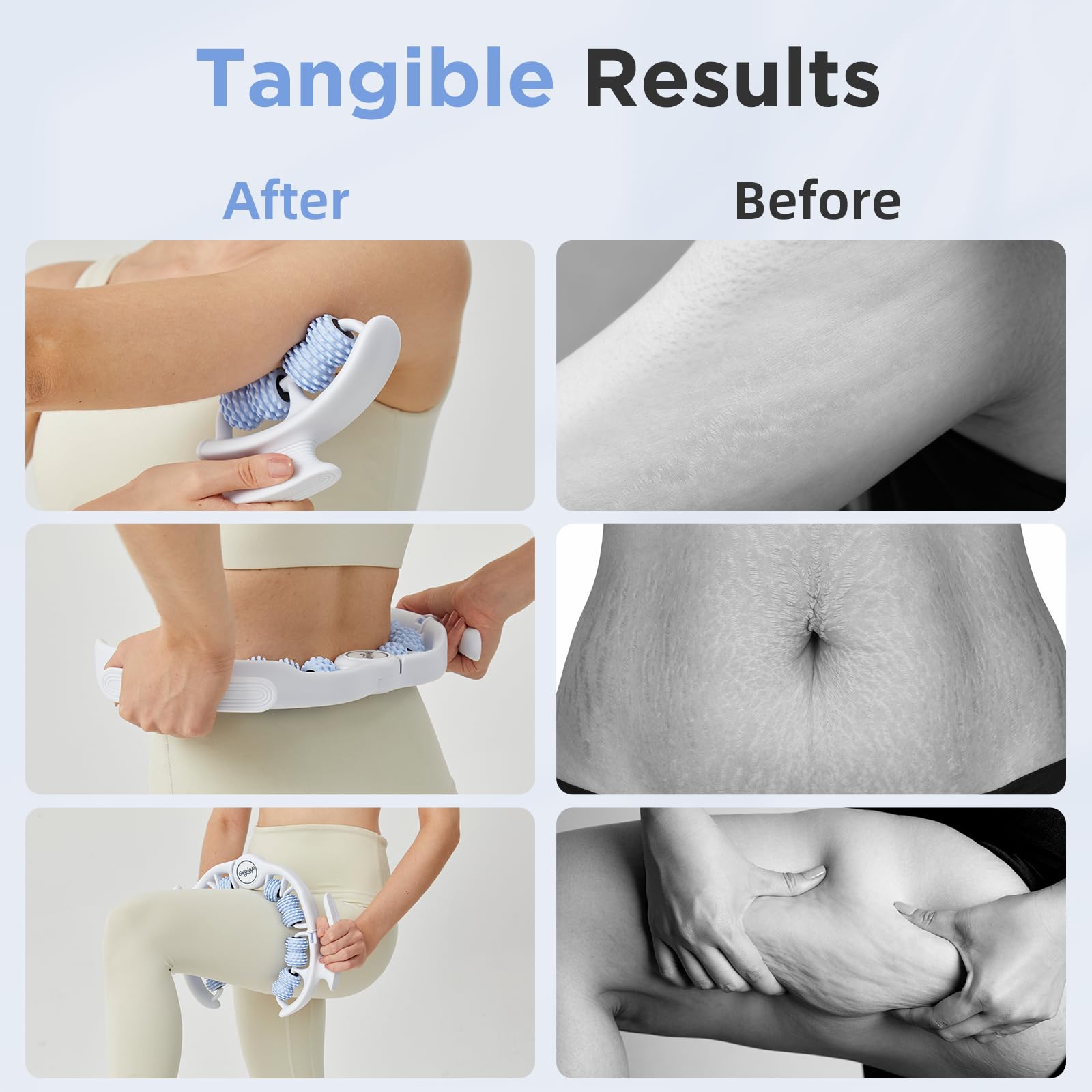 OVGIAP Cellulite Manual Massager for Legs & Thighs - Lymphatic Drainage Tool, Handheld Fascia Blaster for Deep Tissue, Body Sculpting Cellulite Remover(Blue) - Maple Wellness Supplements
