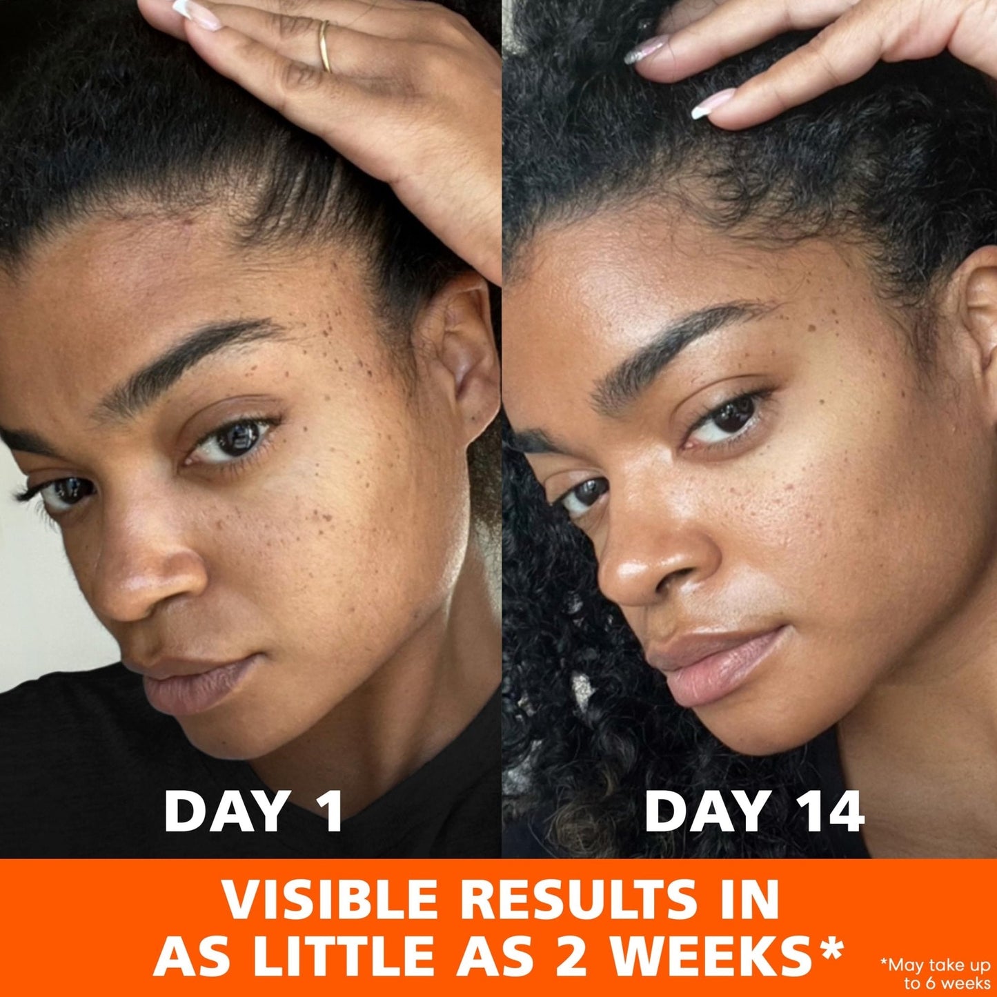 Palmer's Skin Success Anti-Dark Spot Fade Cream with Vitamin E and Niacinamide, for All Skin Types 2.7 Ounce - Maple Wellness Supplements